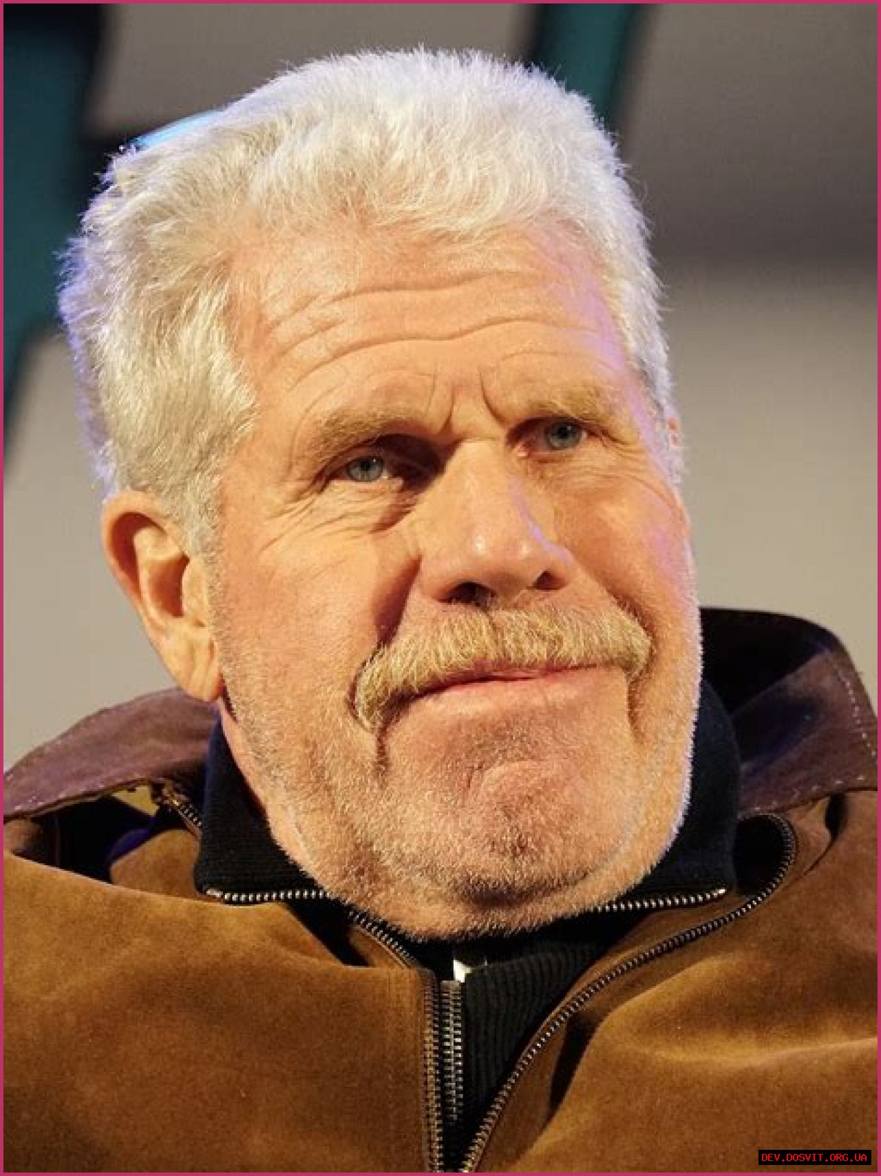 Ron Perlman Condition: Unlocking The Secrets Behind His Distinctive Appearance
