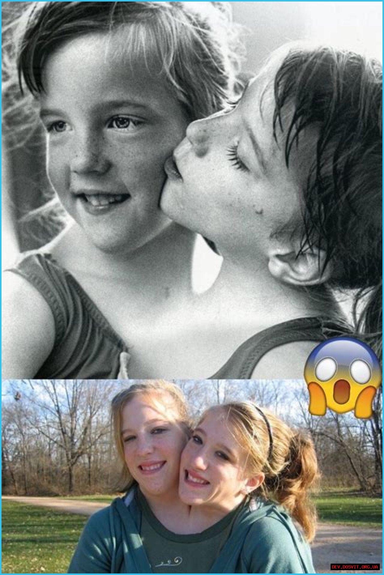 Understanding The Abby And Brittany Hensel Family Tragedy