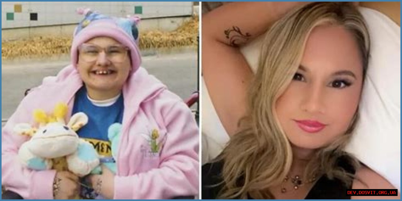 Unveiling The Transformation: The Nose Job Of Gypsy Rose