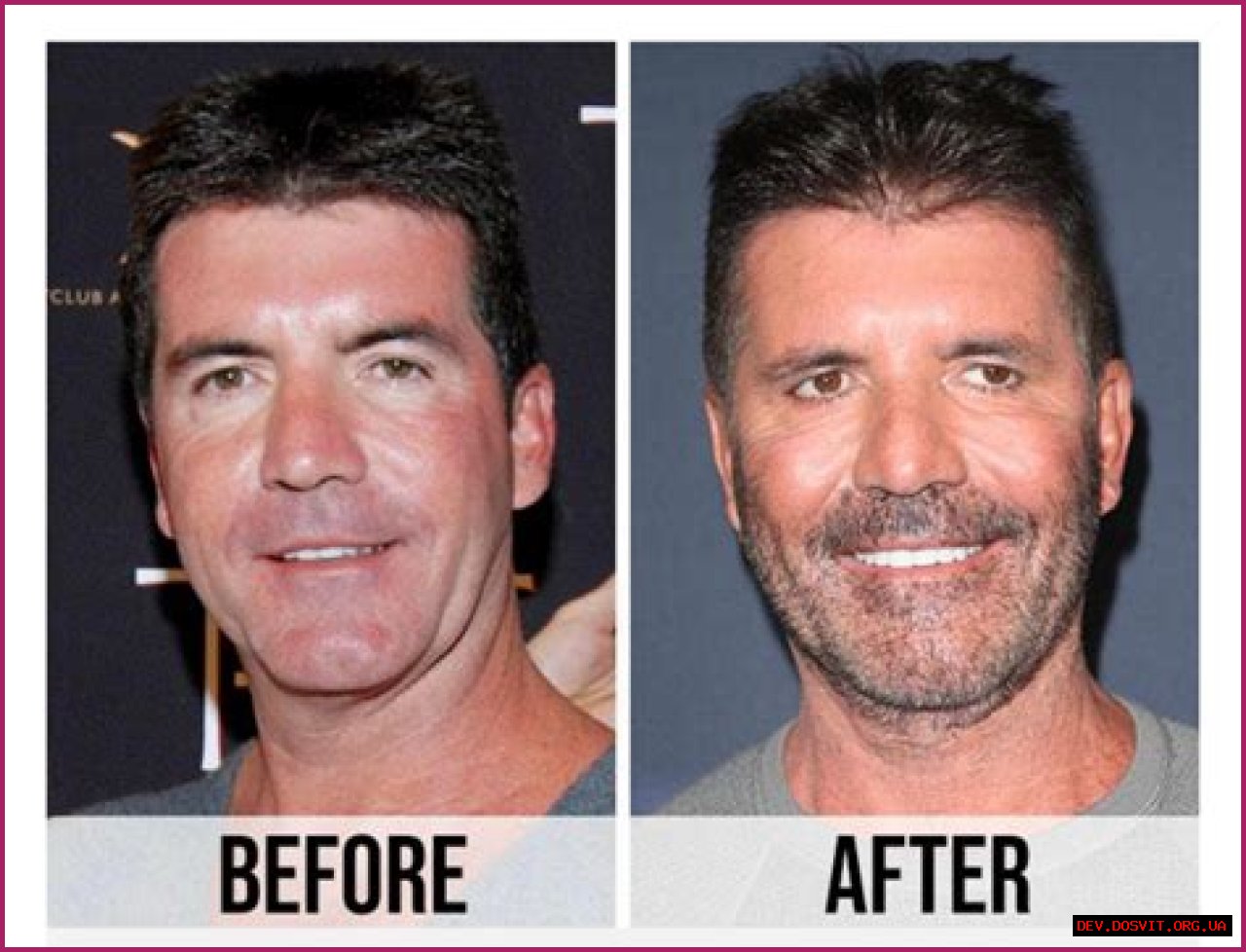 What Is Wrong With Simon Cowell's Son? Understanding The Challenges And Triumphs